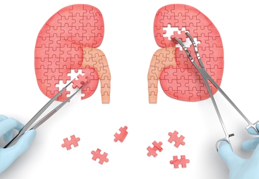 trasplante renal